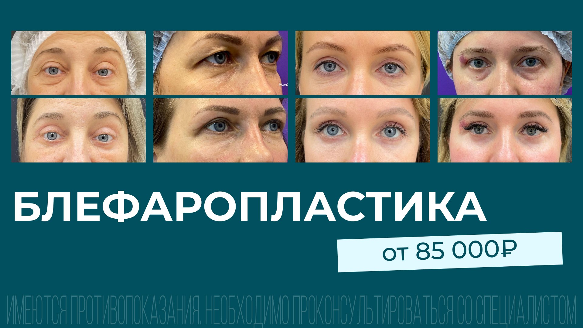 Пластическая хирургия | Роман Кизевадзе