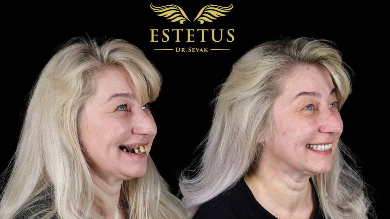 Клиника доктора Севака Estetus